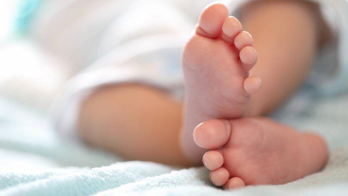 ilustrasi bayi achondroplasia 1 169